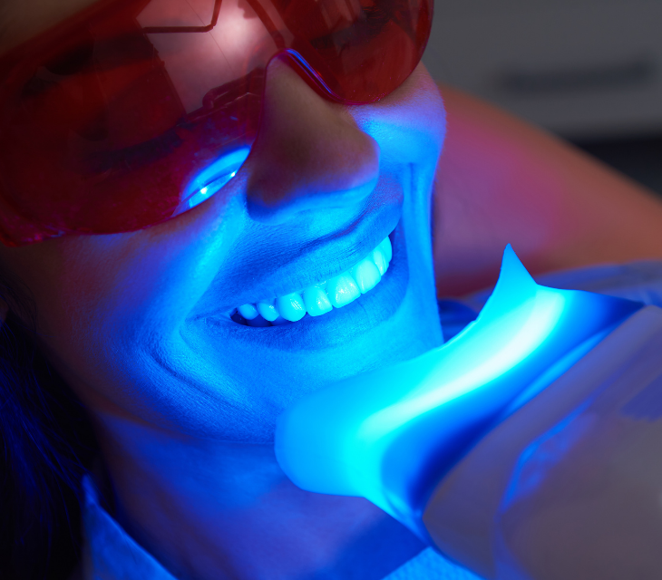 Diş Beyazlatma (Bleaching) image